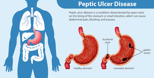 Stomach Ulcers - Ayurvedic medicine